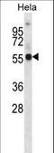 Potassium Voltage-Gated Channel Subfamily A Member 1 antibody, LS-C165408, Lifespan Biosciences, Western Blot image 