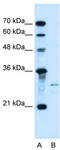 Sonic Hedgehog Signaling Molecule antibody, TA334657, Origene, Western Blot image 