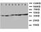 Phosphoglycerate Kinase 1 antibody, LS-C313171, Lifespan Biosciences, Western Blot image 