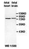 Zinc Finger BED-Type Containing 5 antibody, orb77661, Biorbyt, Western Blot image 