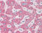 Alpha-1-antitrypsin antibody, 49-015, ProSci, Immunohistochemistry paraffin image 