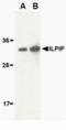 STE20 Related Adaptor Beta antibody, TA306142, Origene, Western Blot image 