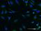 Serine/threonine-protein kinase SIK2 antibody, MA5-21433, Invitrogen Antibodies, Immunofluorescence image 