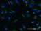 Salt Inducible Kinase 2 antibody, MA5-21433, Invitrogen Antibodies, Immunofluorescence image 