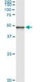 Pseudouridine Synthase 1 antibody, H00080324-M01, Novus Biologicals, Immunoprecipitation image 