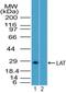 Linker For Activation Of T Cells antibody, NBP2-27104, Novus Biologicals, Western Blot image 