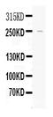 Apolipoprotein B antibody, PB10042, Boster Biological Technology, Western Blot image 