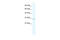 Chloride Intracellular Channel 2 antibody, 28-235, ProSci, Western Blot image 