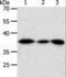 Aldo-Keto Reductase Family 1 Member A1 antibody, LS-C402611, Lifespan Biosciences, Western Blot image 
