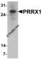 Paired mesoderm homeobox protein 1 antibody, 8093, ProSci, Western Blot image 