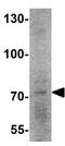 HDGF Like 2 antibody, GTX32024, GeneTex, Western Blot image 