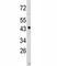 N-Myc Downstream Regulated 1 antibody, F49973-0.4ML, NSJ Bioreagents, Western Blot image 