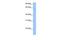 Chaperonin Containing TCP1 Subunit 6B antibody, GTX45480, GeneTex, Western Blot image 