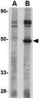 Cytokine Receptor Like Factor 2 antibody, GTX85439, GeneTex, Western Blot image 