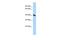 Putative endonuclease FLJ39025 homolog antibody, A07888, Boster Biological Technology, Western Blot image 