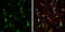Calcium/Calmodulin Dependent Protein Kinase II Beta antibody, GTX133072, GeneTex, Immunocytochemistry image 