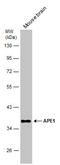 Apurinic/Apyrimidinic Endodeoxyribonuclease 1 antibody, GTX110558, GeneTex, Western Blot image 