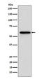 Retinoic Acid Receptor Beta antibody, M01912, Boster Biological Technology, Western Blot image 