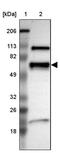 N-Myristoyltransferase 2 antibody, PA5-51554, Invitrogen Antibodies, Western Blot image 