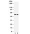 Cystatin A antibody, R31860, NSJ Bioreagents, Western Blot image 