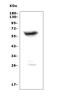 Preferentially Expressed Antigen In Melanoma antibody, A06628-2, Boster Biological Technology, Western Blot image 