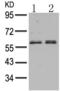 Histone Deacetylase 2 antibody, TA323156, Origene, Western Blot image 