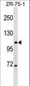 Chloride Voltage-Gated Channel 3 antibody, LS-C159361, Lifespan Biosciences, Western Blot image 