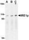 Endoplasmic Reticulum To Nucleus Signaling 1 antibody, AHP1012, Bio-Rad (formerly AbD Serotec) , Western Blot image 