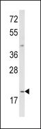 Interleukin 12A antibody, GTX81020, GeneTex, Western Blot image 