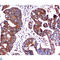 Heat Shock Protein Family A (Hsp70) Member 5 antibody, LS-C812893, Lifespan Biosciences, Immunohistochemistry paraffin image 