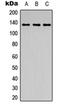 ABL Proto-Oncogene 1, Non-Receptor Tyrosine Kinase antibody, orb304676, Biorbyt, Western Blot image 