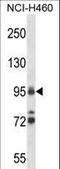 DNA topoisomerase 1 antibody, LS-C160113, Lifespan Biosciences, Western Blot image 