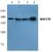 SWI/SNF Related, Matrix Associated, Actin Dependent Regulator Of Chromatin Subfamily C Member 2 antibody, A06370-1, Boster Biological Technology, Western Blot image 