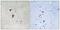 Heat Shock Transcription Factor 1 antibody, GTX55327, GeneTex, Immunohistochemistry paraffin image 