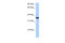 Zinc finger protein 389 antibody, 30-705, ProSci, Enzyme Linked Immunosorbent Assay image 