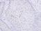 GID Complex Subunit 8 Homolog antibody, GTX106672, GeneTex, Immunohistochemistry paraffin image 