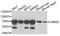 Lamin B2 antibody, STJ28566, St John