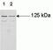 Janus Kinase 3 antibody, AHO1572, Invitrogen Antibodies, Western Blot image 