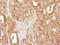 Solute Carrier Family 25 Member 13 antibody, LS-C186038, Lifespan Biosciences, Immunohistochemistry paraffin image 