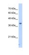 Interaction Protein For Cytohesin Exchange Factors 1 antibody, orb325260, Biorbyt, Western Blot image 