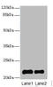 Signal Regulatory Protein Delta antibody, A56972-100, Epigentek, Western Blot image 