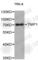 TNFAIP3 Interacting Protein 1 antibody, A4404, ABclonal Technology, Western Blot image 