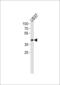 Apolipoprotein L1 antibody, PA5-35329, Invitrogen Antibodies, Western Blot image 