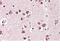 SH3 Domain Containing GRB2 Like 2, Endophilin A1 antibody, NBP2-26164, Novus Biologicals, Immunohistochemistry paraffin image 