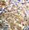 Protein Kinase C Zeta antibody, STJ22346, St John