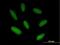 Zinc Finger Imprinted 2 antibody, H00023619-B01P, Novus Biologicals, Immunocytochemistry image 