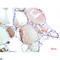 Transthyretin antibody, LS-C813253, Lifespan Biosciences, Immunohistochemistry paraffin image 