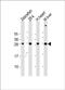 Adenylate Kinase 2 antibody, PA5-49482, Invitrogen Antibodies, Western Blot image 