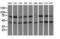 Heat Shock Protein Family A (Hsp70) Member 6 antibody, M05402, Boster Biological Technology, Western Blot image 