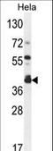 Delta 4-Desaturase, Sphingolipid 2 antibody, LS-C167353, Lifespan Biosciences, Western Blot image 